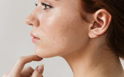 Ohrläppchenkorrektur