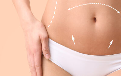 Lipolyse – Fett weg Spritze